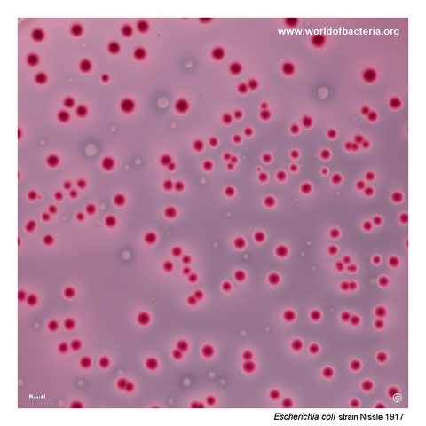 Experimental mixed culture showing inhibition of Shigella flexneri colony growth near Escherichia coli Nissle 1917
