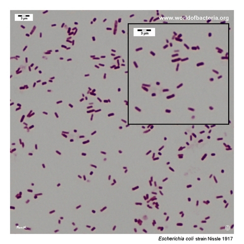 Gram-stained Escherichia coli Nissle 1917 showing Gram-negative rods