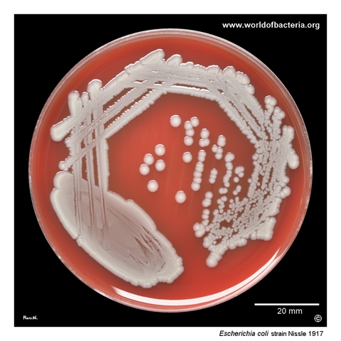 Escherichia coli Nissle 1917 colonies on blood agar after 24 hours