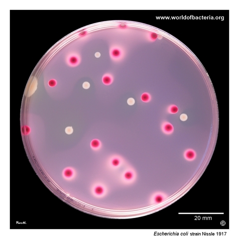 Escherichia coli Nissle 1917 and Shigella flexneri colonies compared on MacConkey agar