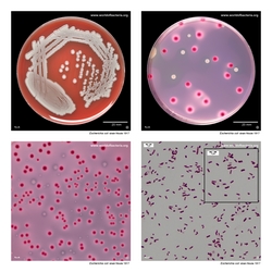 Composite laboratory image panel of Escherichia coli Nissle 1917 with preview photographs from the species overview page