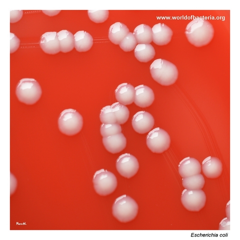 Convex non-haemolytic Escherichia coli colonies on blood agar after 24 hours