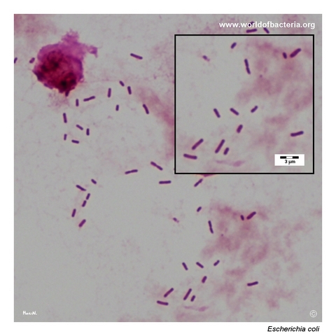 Gram-stained urine specimen with numerous Gram-negative rods identified as Escherichia coli