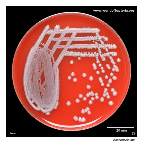 Pure culture of non-haemolytic Escherichia coli from midstream urine on blood agar