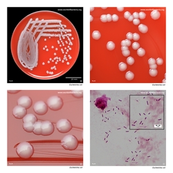 Composite laboratory image panel of Escherichia coli with preview photographs from the species overview page