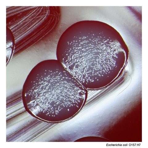 Close-up of Escherichia coli O157:H7 colonies on blood agar