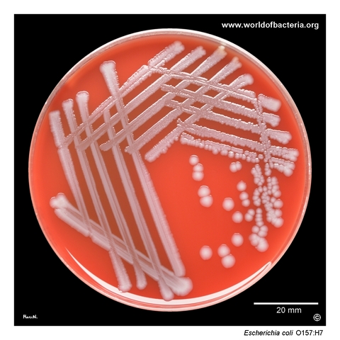 Escherichia coli O157:H7 Shiga toxin 2-producing isolate cultured from a stool specimen