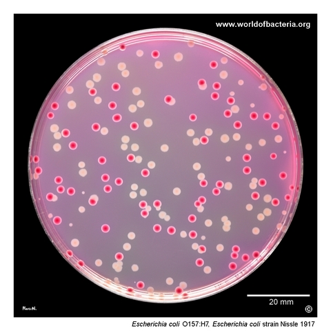 Escherichia coli O157:H7 and Escherichia coli Nissle 1917 compared on sorbitol MacConkey agar