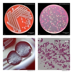 Composite laboratory image panel of Escherichia coli O157:H7 with preview photographs from the species overview page