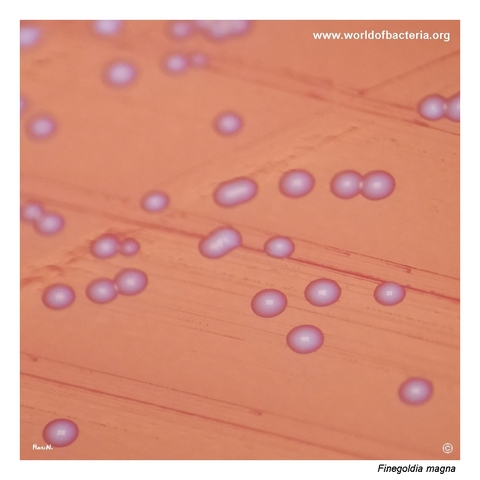 Close-up of smooth convex colonies of Finegoldia magna