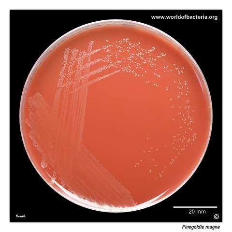 Finegoldia magna on Schaedler agar after anaerobic incubation