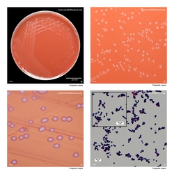 Composite laboratory image panel of Finegoldia magna with preview photographs from the species overview page