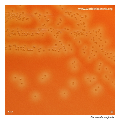 Beta-haemolytic colonies of Gardnerella vaginalis on specialised medium