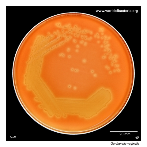 Gardnerella vaginalis collection strain on rabbit-erythrocyte agar