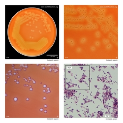 Composite laboratory image panel of Gardnerella vaginalis with preview photographs from the species overview page