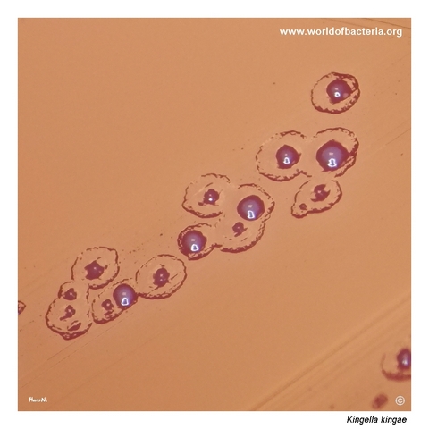 Two morphological variants of Kingella kingae colonies on blood agar