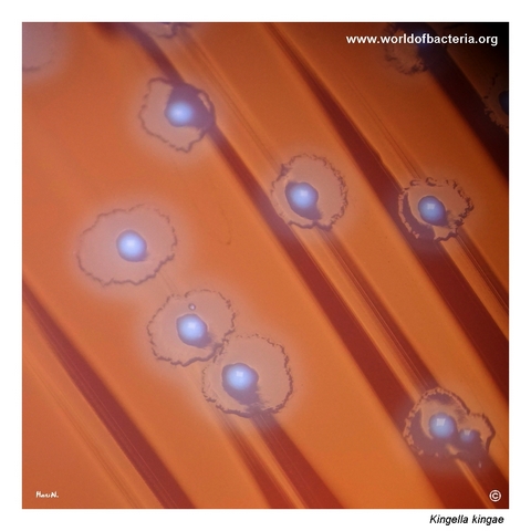 Fried-egg colony morphology of Kingella kingae on blood agar