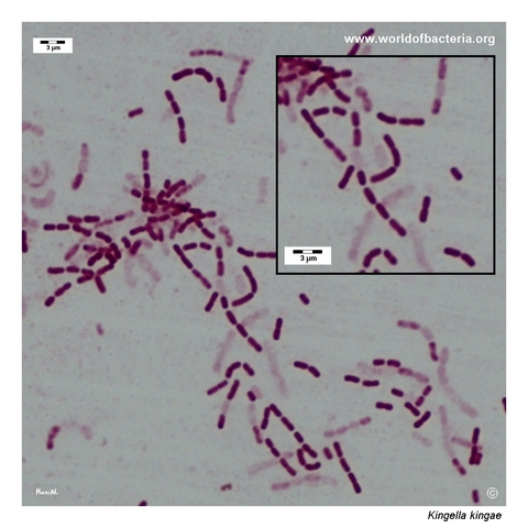 Short Gram-negative Kingella kingae rods and coccobacilli in pairs and short chains