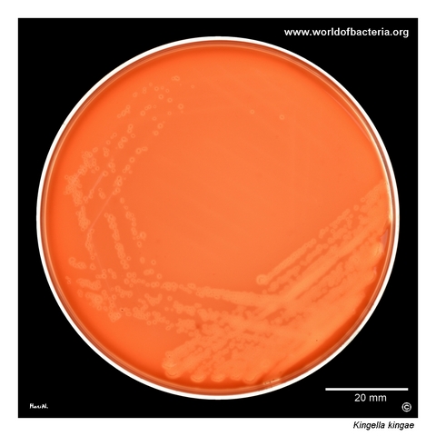 Very small beta-haemolytic Kingella kingae colonies from a blood culture