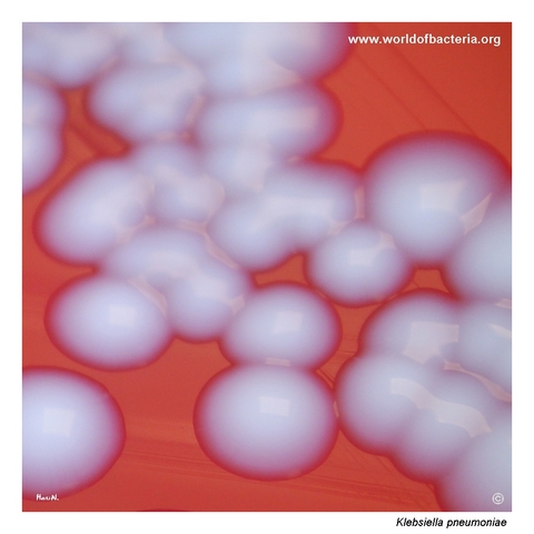 Close-up of smooth convex round Klebsiella pneumoniae colonies with a glistening surface