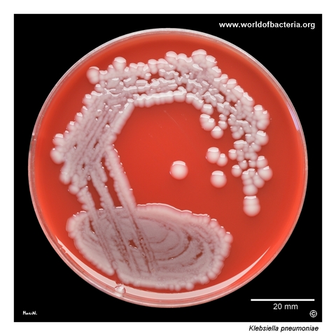 Klebsiella pneumoniae in a urine culture with medium-sized to large smooth glistening colonies on blood agar