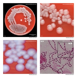 Composite laboratory image panel of Klebsiella pneumoniae with preview photographs from the species overview page