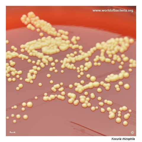Small yellow colonies of Kocuria rhizophila on blood agar