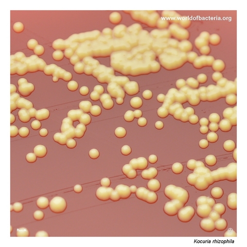 Close-up view of yellow colonies of Kocuria rhizophila on blood agar