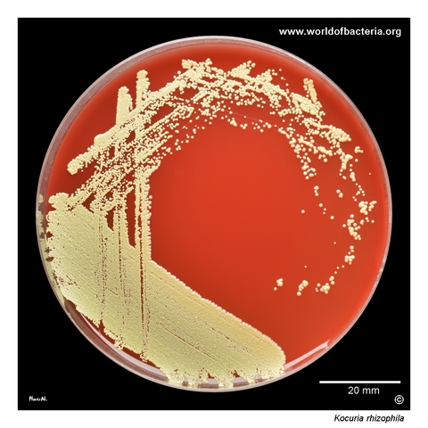 Kocuria rhizophila colonies on blood agar from aerobic blood culture work