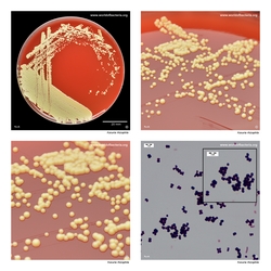 Composite laboratory image panel of Kocuria rhizophila with preview photographs from the species overview page
