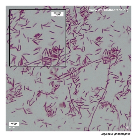 Long slender Gram-negative Legionella pneumophila rods and filamentous forms from a mature culture