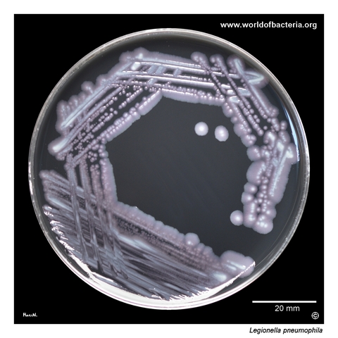 Legionella pneumophila colonies on Legionella GVPC selective medium after five days