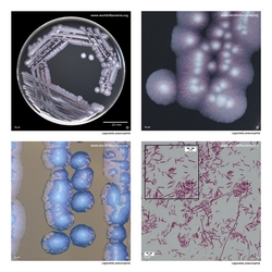 Composite laboratory image panel of Legionella pneumophila with preview photographs from the species overview page