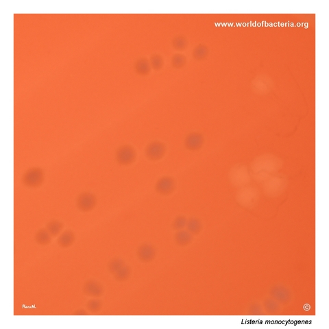 Colonies of Listeria monocytogenes on blood agar photographed in transmitted light