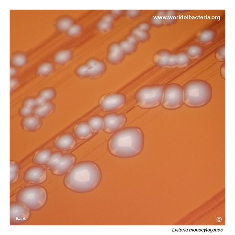 Close-up view of Listeria monocytogenes colonies after 48 hours in 5% CO2