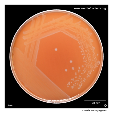 Listeria monocytogenes on blood agar with subtle beta-haemolysis after 48 hours in 5% CO2
