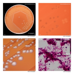 Composite laboratory image panel of Listeria monocytogenes with preview photographs from the species overview page