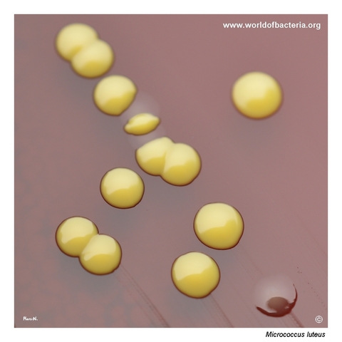 Yellow colonies of Micrococcus luteus on blood agar with non-pigmented Neisseria meningitidis colonies