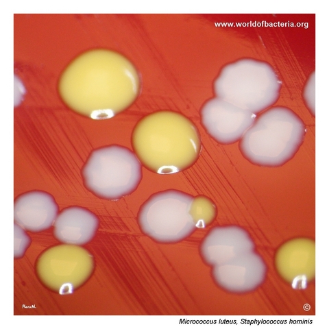 Pigmented Micrococcus luteus colonies and non-pigmented Staphylococcus hominis colonies on blood agar