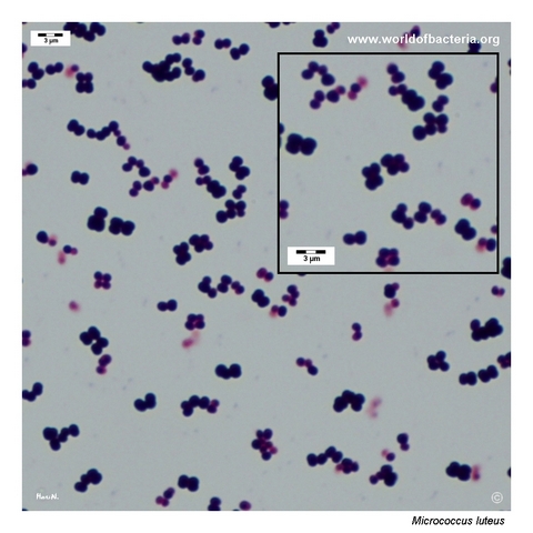Gram-stained smear from a colony of Micrococcus luteus grown on blood agar
