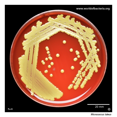 Micrococcus luteus colonies on blood agar from accidental laboratory contamination