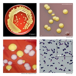 Composite laboratory image panel of Micrococcus luteus with preview photographs from the species overview page
