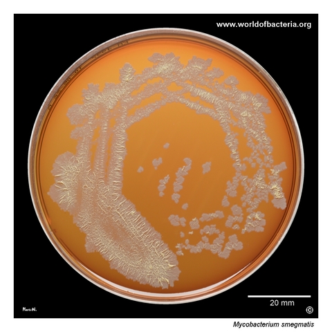 Mycobacterium smegmatis collection strain growing on blood agar after 5 days