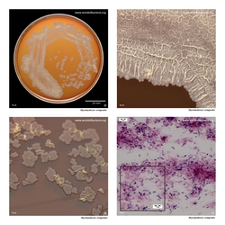 Composite laboratory image panel of Mycobacterium smegmatis with preview photographs from the species overview page