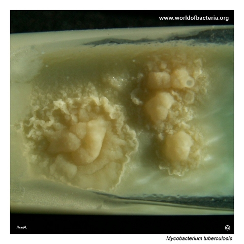 Mycobacterium tuberculosis colonies on Löwenstein–Jensen medium after prolonged incubation