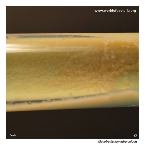 Confluent rough growth of Mycobacterium tuberculosis on Ogawa medium
