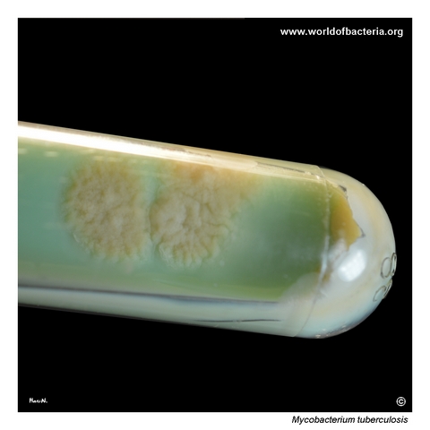 Mycobacterium tuberculosis colonies on Ogawa medium after prolonged incubation
