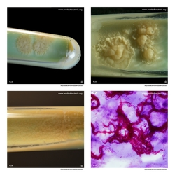 Composite laboratory image panel of Mycobacterium tuberculosis with preview photographs from the species overview page