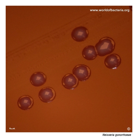 Small Neisseria gonorrhoeae colonies with slightly irregular margins on selective agar