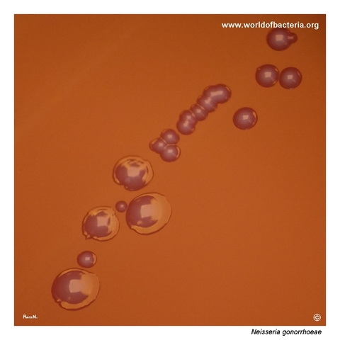 Heterogeneous colony population of Neisseria gonorrhoeae differing in size and morphology